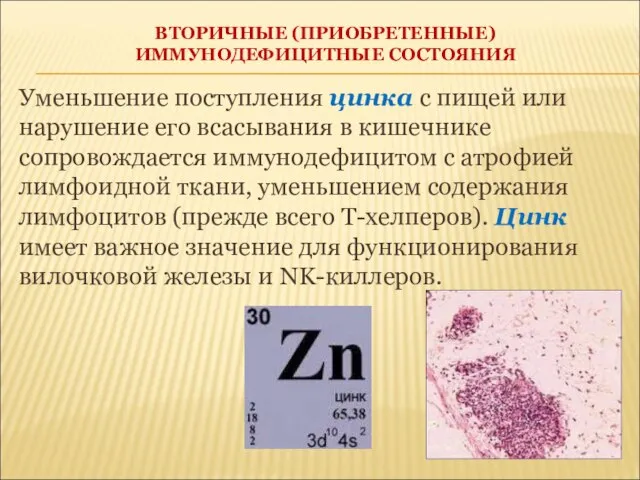 ВТОРИЧНЫЕ (ПРИОБРЕТЕННЫЕ) ИММУНОДЕФИЦИТНЫЕ СОСТОЯНИЯ Уменьшение поступления цинка с пищей или нарушение его