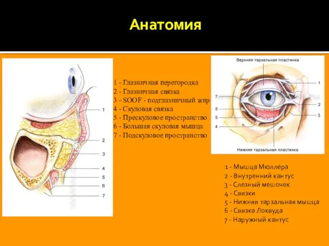 Анатомия 1 - Мышца Мюллера 2 - Внутренний кантус 3 - Слезный