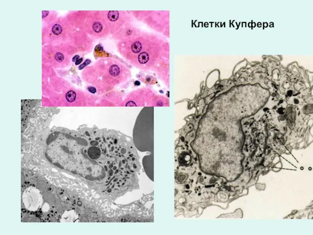 Клетки Купфера