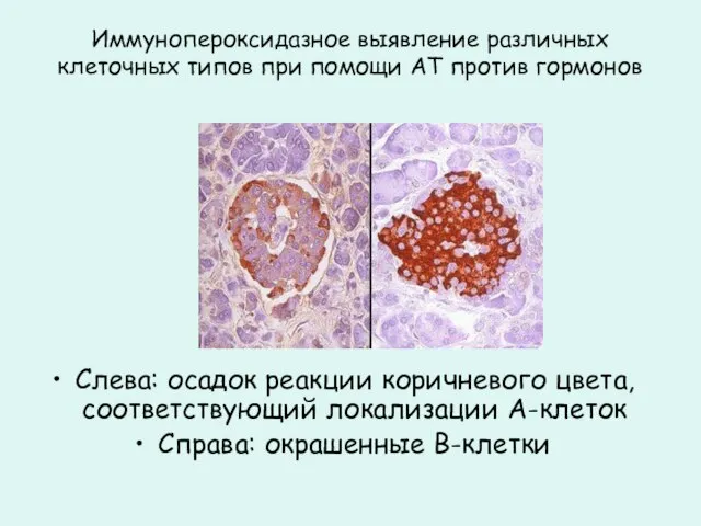 Иммунопероксидазное выявление различных клеточных типов при помощи АТ против гормонов Слева: осадок