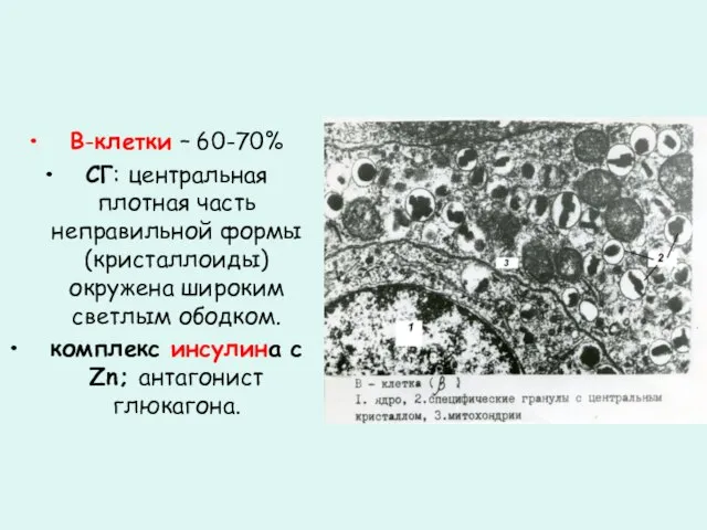 В-клетки – 60-70% СГ: центральная плотная часть неправильной формы (кристаллоиды) окружена широким