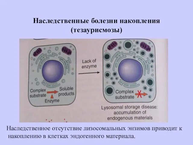 Наследственные болезни накопления (тезаурисмозы) Наследственное отсутствие лизосомальных энзимов приводит к накоплению в клетках эндогенного материала.