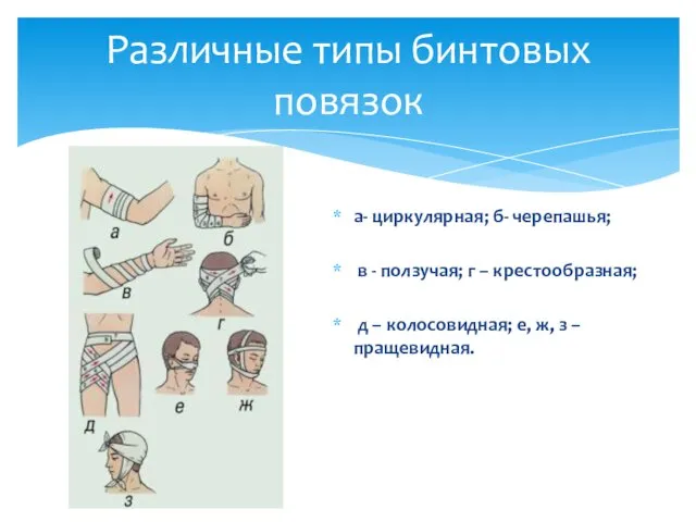 а- циркулярная; б- черепашья; в - ползучая; г – крестообразная; д –