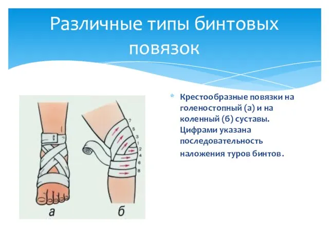 Крестообразные повязки на голеностопный (а) и на коленный (б) суставы. Цифрами указана