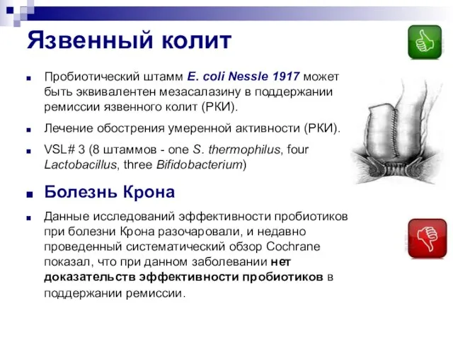 Язвенный колит Пробиотический штамм E. coli Nessle 1917 может быть эквивалентен мезасалазину