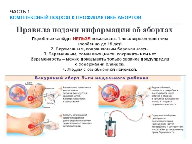 Правила подачи информации об абортах Подобные слайды НЕЛЬЗЯ показывать 1.несовершеннолетним (особенно до