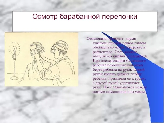 Осмотр барабанной перепонки Отоскопию проводят двумя глазами, причем левым глазом обязательно через