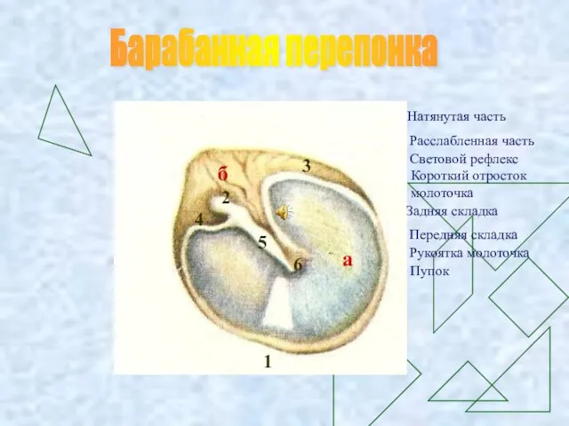 Барабанная перепонка а Натянутая часть б Расслабленная часть 1 Световой рефлекс 2