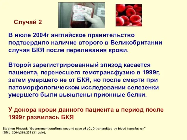 В июле 2004г английское правительство подтвердило наличие второго в Великобритании случая БКЯ