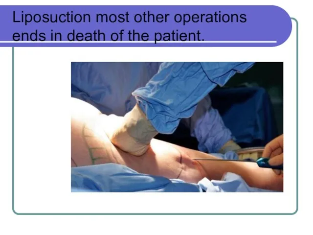 Liposuction most other operations ends in death of the patient.