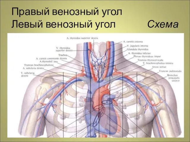 Правый венозный угол Левый венозный угол Схема