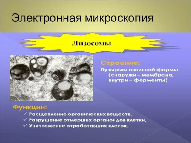 Электронная микроскопия