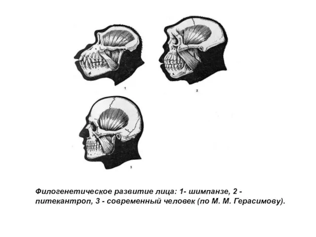 Филогенетическое развитие лица: 1- шимпанзе, 2 - питекантроп, 3 - современный человек (по М. М. Герасимову).