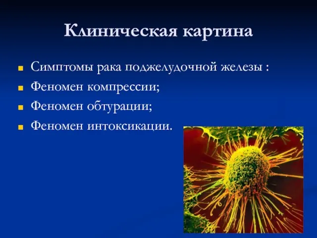 Клиническая картина Симптомы рака поджелудочной железы : Феномен компрессии; Феномен обтурации; Феномен интоксикации.