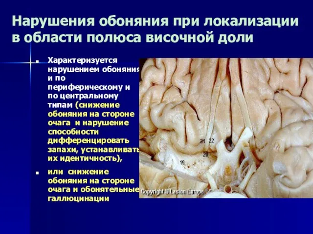 Нарушения обоняния при локализации в области полюса височной доли Характеризуется нарушением обоняния