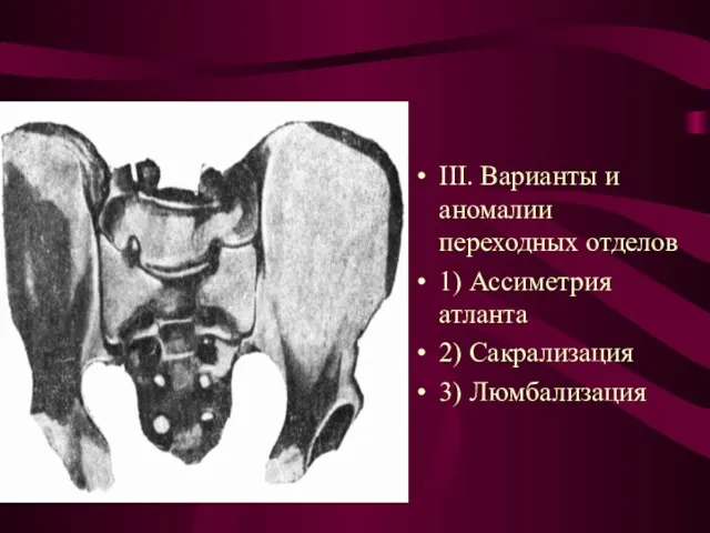 III. Варианты и аномалии переходных отделов 1) Ассиметрия атланта 2) Сакрализация 3) Люмбализация