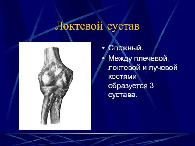 Локтевой сустав Сложный. Между плечевой, локтевой и лучевой костями образуется 3 сустава.