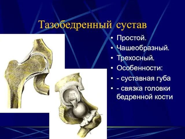 Тазобедренный сустав Простой. Чашеобразный. Трехосный. Особенности: - суставная губа - связка головки бедренной кости