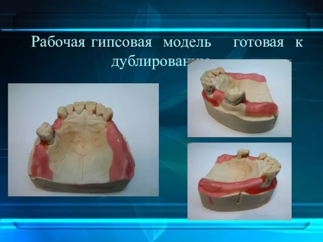 Рабочая гипсовая модель готовая к дублированию