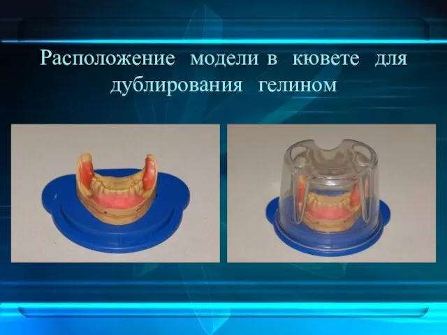 Расположение модели в кювете для дублирования гелином