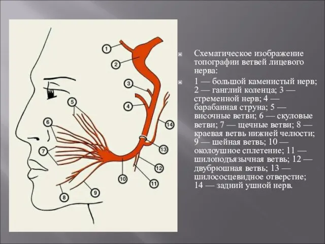 Схематическое изображение топографии ветвей лицевого нерва: 1 — большой каменистый нерв; 2