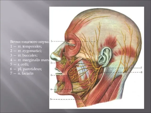 Ветви лицевого нерва. 1 — rr. temporales; 2 — rr. zygomatici; 3