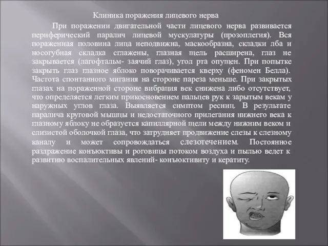 Клиника поражения лицевого нерва При поражении двигательной части лицевого нерва развивается периферический