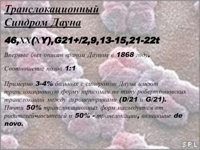 Транслокационный Синдром Дауна 46,ХХ(ХY),G21+/2,9,13-15,21-22t Примерно 3-4% больных с синдромом Дауна имеют транслокационную