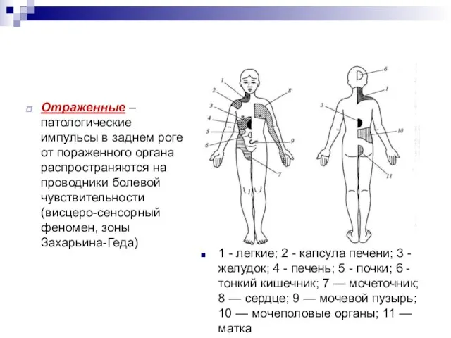 Отраженные – патологические импульсы в заднем роге от пораженного органа распространяются на