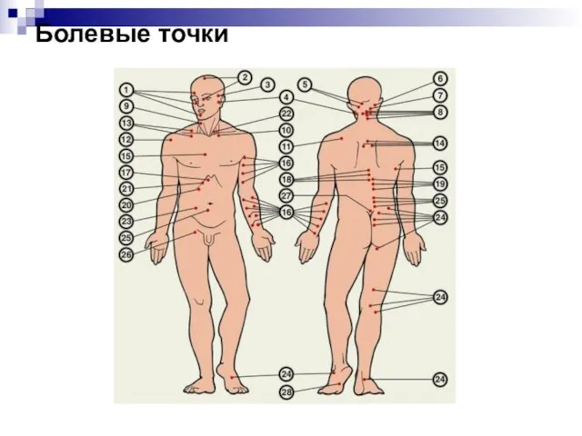 Болевые точки