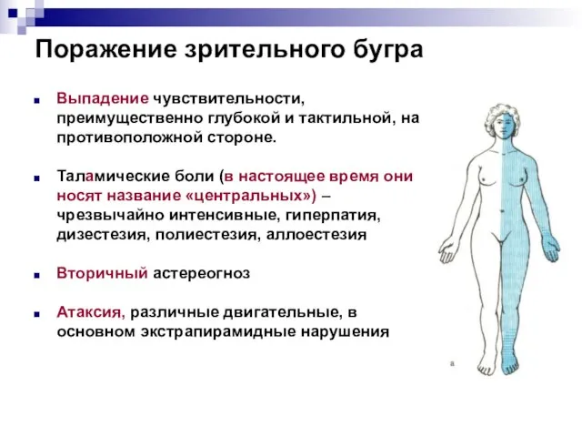 Поражение зрительного бугра Выпадение чувствительности, преимущественно глубокой и тактильной, на противоположной стороне.