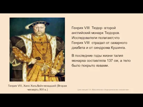 Цикл лекций Г.А. Мельниченко «Эндокринология в искусстве» Генрих VIII, Ханс Хольбейн-младший (Вторая