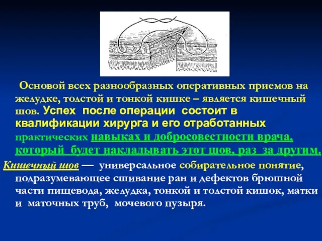 Основой всех разнообразных оперативных приемов на желудке, толстой и тонкой кишке –