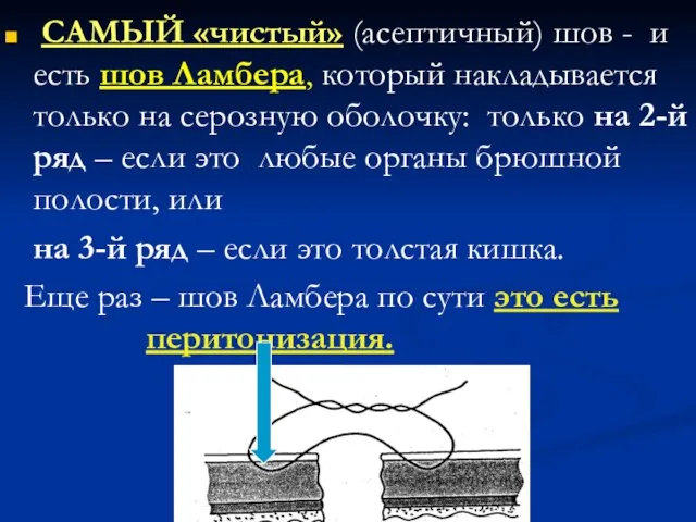 САМЫЙ «чистый» (асептичный) шов - и есть шов Ламбера, который накладывается только