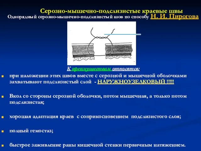 Серозно-мышечно-подслизистые краевые швы К преимуществам относятся: при наложении этих швов вместе с