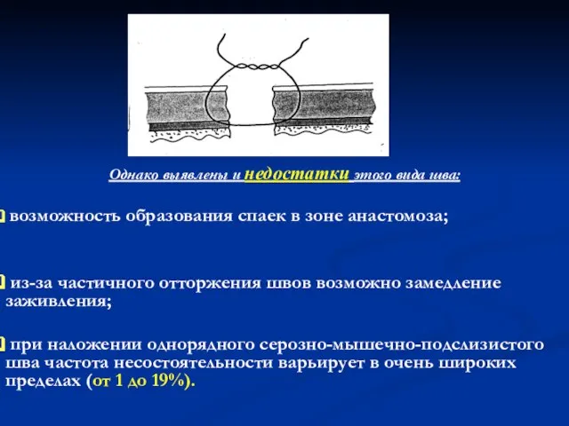 Однако выявлены и недостатки этого вида шва: возможность образования спаек в зоне