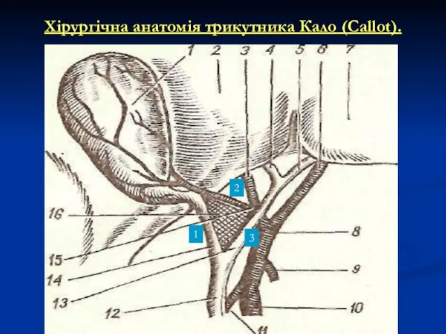 Хірургічна анатомія трикутника Кало (Callot). 1 2 3