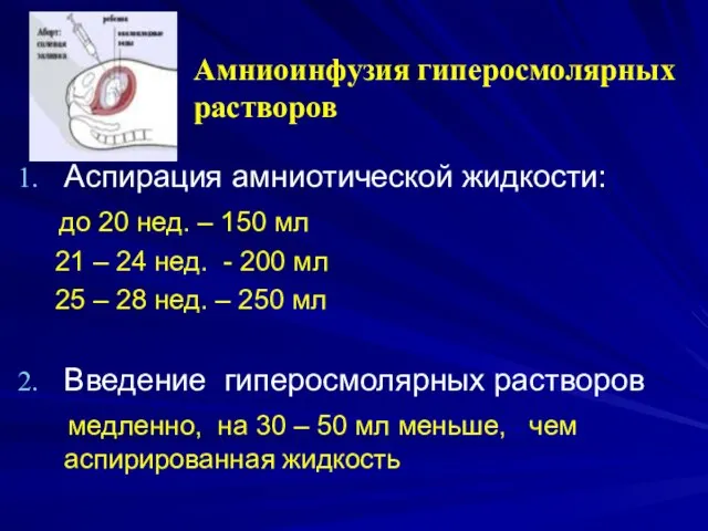 Амниоинфузия гиперосмолярных растворов Аспирация амниотической жидкости: до 20 нед. – 150 мл