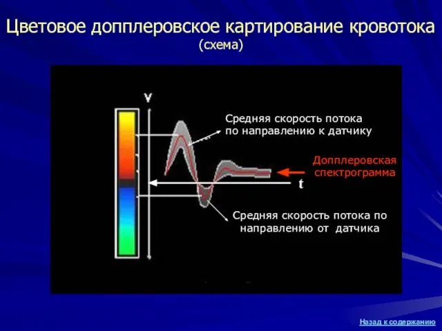 Цветовое допплеровское картирование кровотока (схема) Средняя скорость потока по направлению к датчику