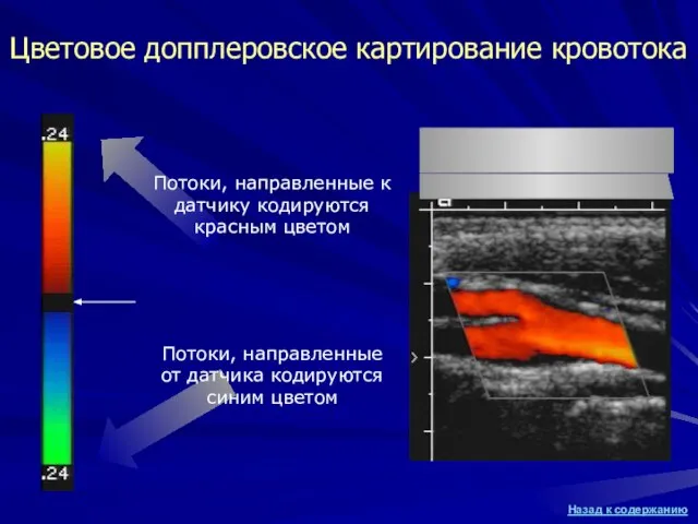 Цветовое допплеровское картирование кровотока