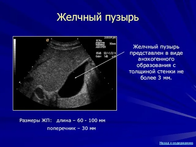 Желчный пузырь Желчный пузырь представлен в виде анэхогенного образования с толщиной стенки