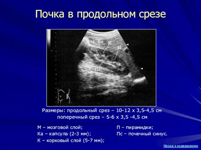 Почка в продольном срезе М – мозговой слой; Ка – капсула (2-3