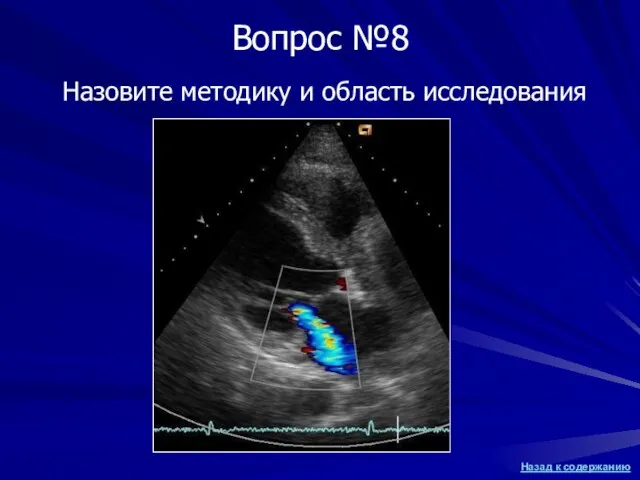 Назовите методику и область исследования Вопрос №8