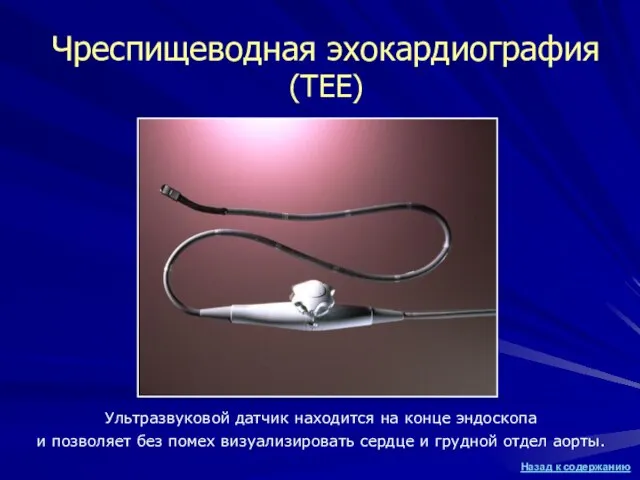 Чреспищеводная эхокардиография (TEE) Ультразвуковой датчик находится на конце эндоскопа и позволяет без