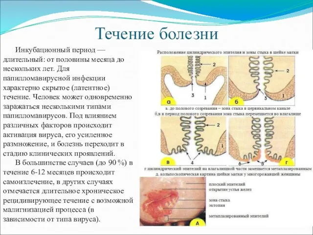 Течение болезни Инкубационный период — длительный: от половины месяца до нескольких лет.