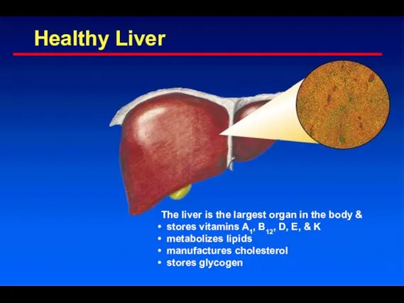 Healthy Liver The liver is the largest organ in the body &