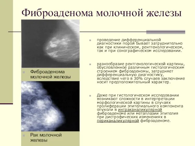 проведение дифференциальной диагностики порой бывает затруднительно как при клиническом, рентгенологическом, так и