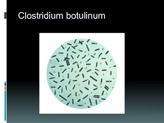 Clostridium botulinum