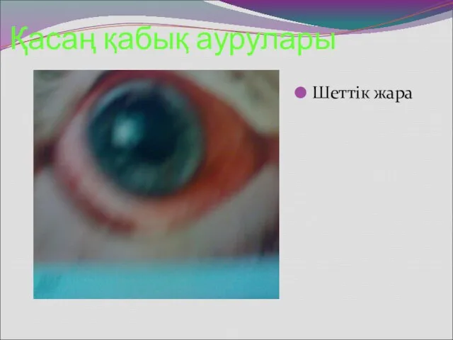 Қасаң қабық аурулары Шеттік жара