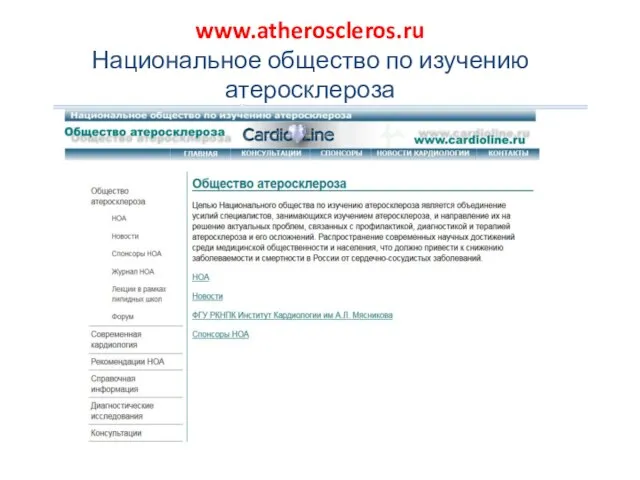 www.atheroscleros.ru Национальное общество по изучению атеросклероза